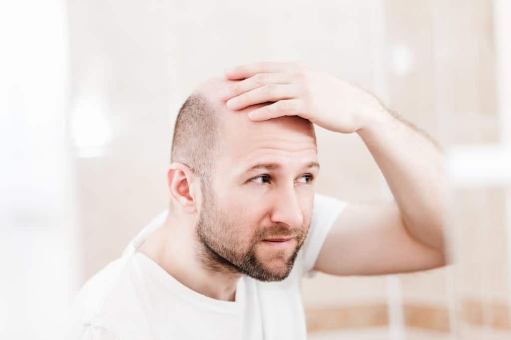 Choose The Best Moisturizer For A Bald Head