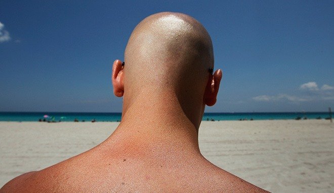 Best Sunscreens for Bald Heads