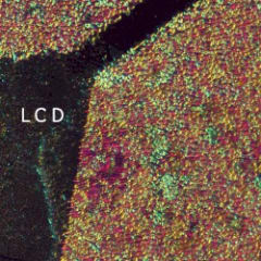 LCD