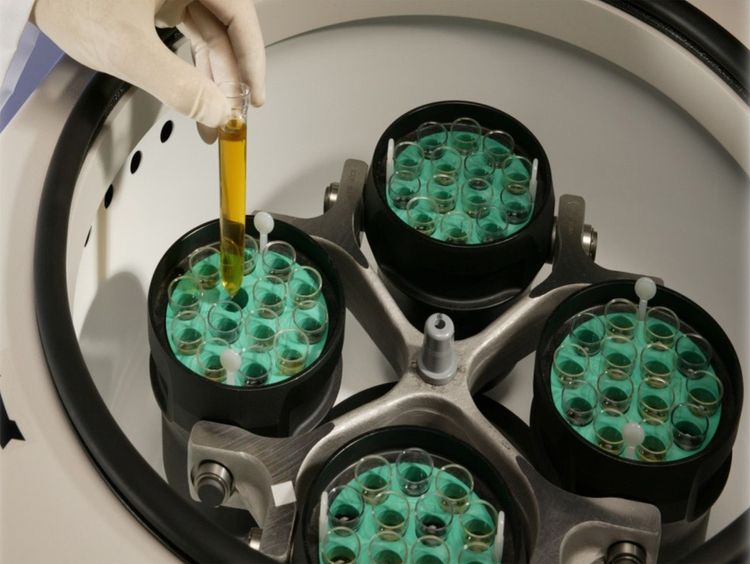 Urinalysis Testing Kits cover image