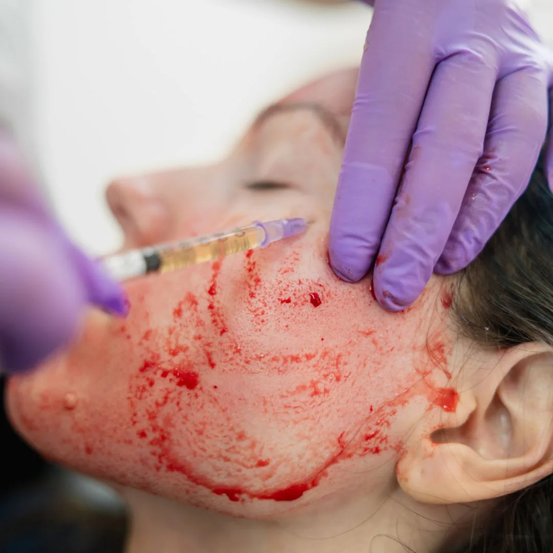 Specialised Facials
