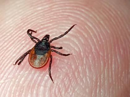 В Ленинском районе увеличилось количество укусов людей клещами