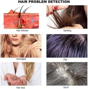 SSW M-906 Hair and Scalp Analyzer 3