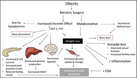 How Bariatric Surgery Changes Your Appetite And Metabolism? | The Sleeve Clinic How Bariatric Surgery Changes Your Appetite And Metabolism? | The Sleeve Clinic