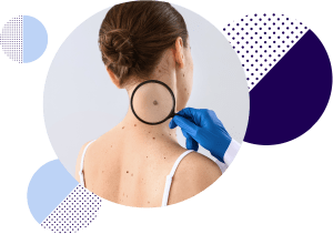Patient facing away, with a magnifying glass hovering over a mole on her neck.