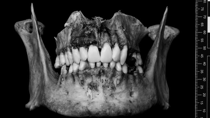 FORENSIC ODONTOLOGY: A CONTEMPORARY VIEWPOINT
