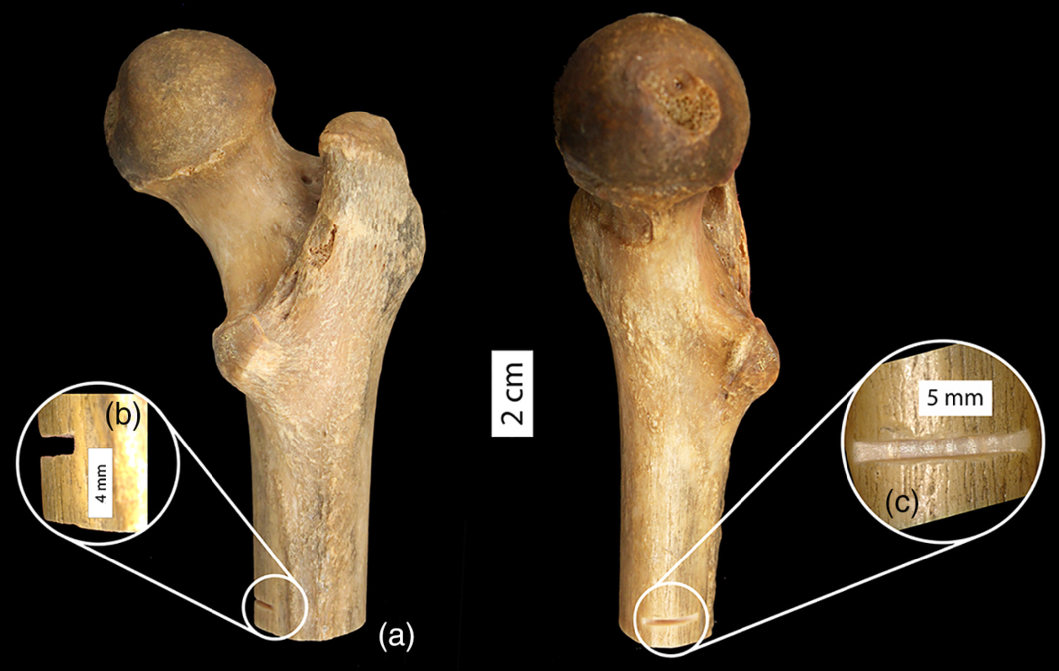 Postmortem modifications of skeletal remains