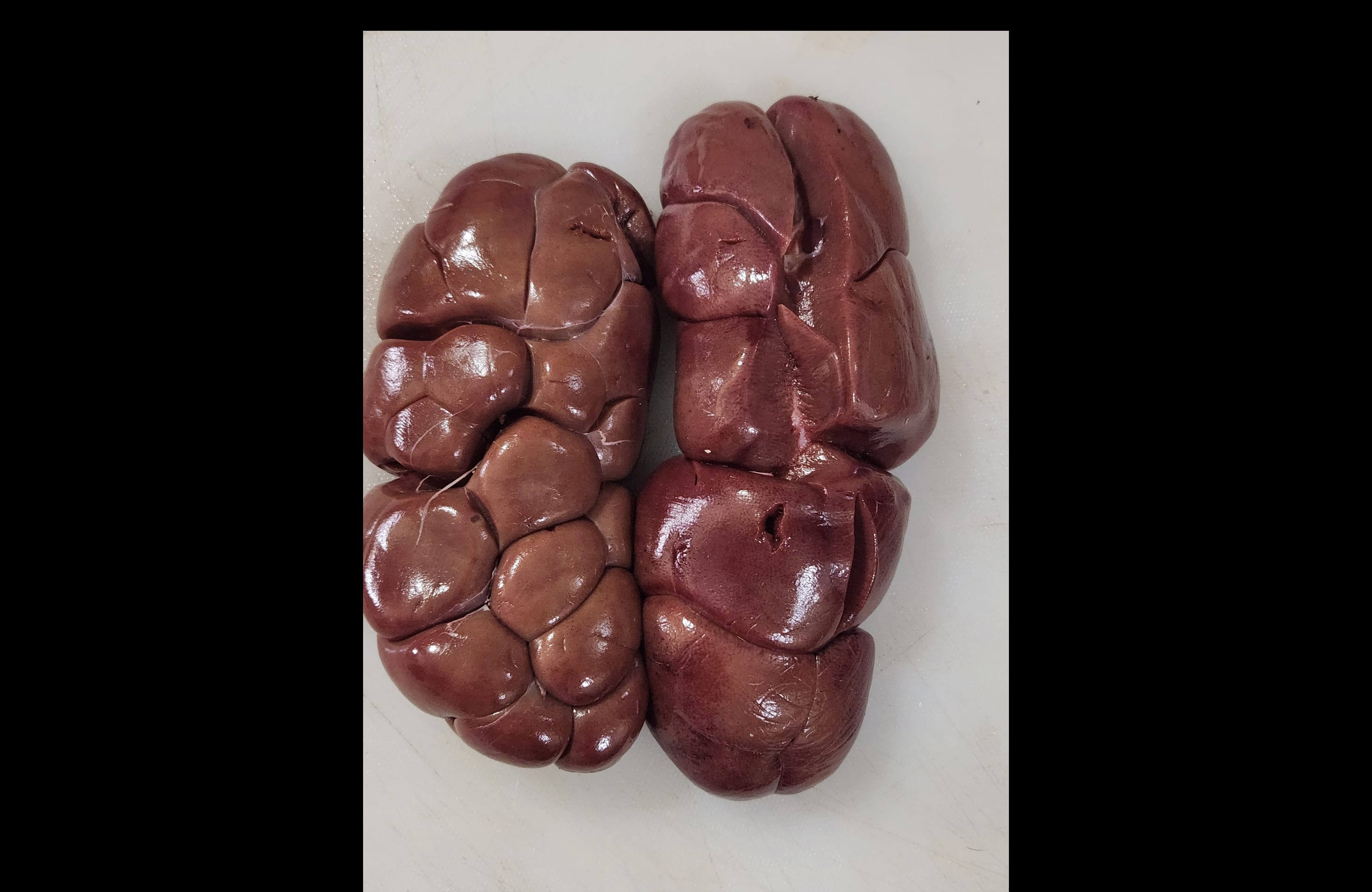 Kidney — image 1