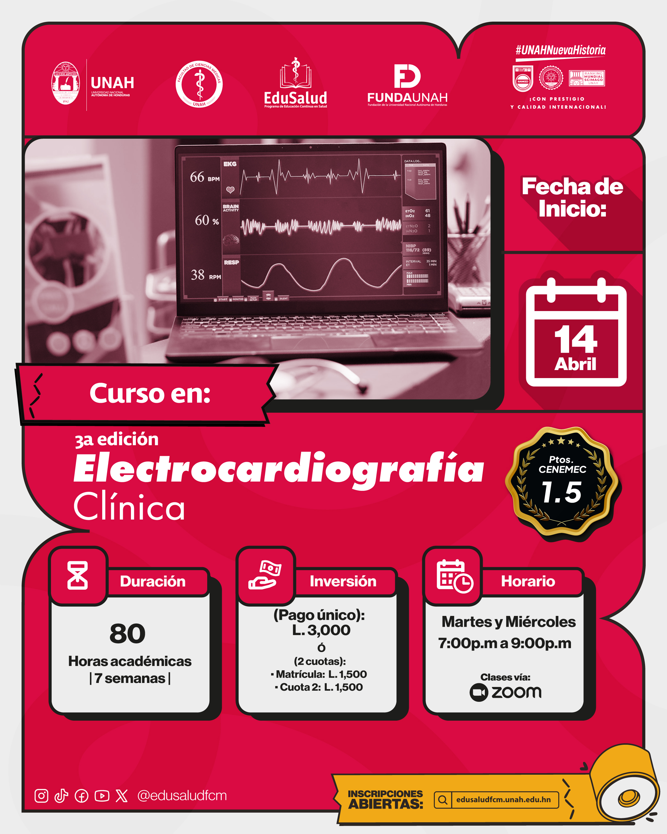EKG Clínica