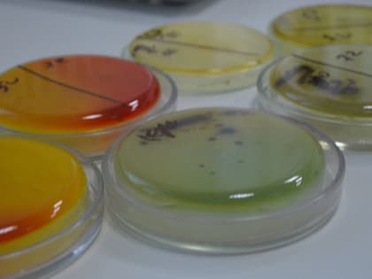 Озвучена причина острой кишечной инфекции у балаковских школьников