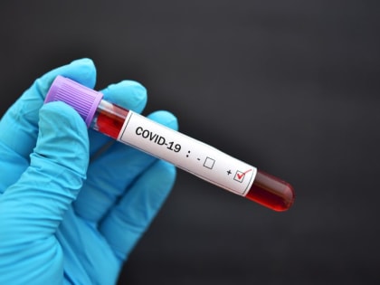 На утро 24 января в Саратовской области зарегистрировали 91 новый случай заболевания жителей коронавирусом