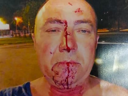 Власти Саратовской области ответили на обращение гражданина