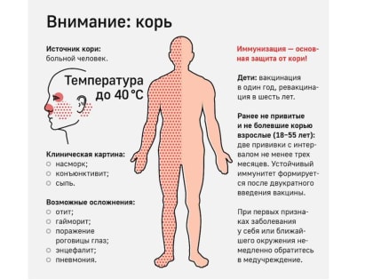 С начала года в регионе выявлено два очага кори