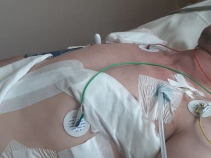 Балаковские врачи спасли мужчину с ножевым ранением в сердце