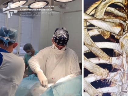 Саратовские врачи провели 10 операций пациентке с переломанными рёбрами и повреждённой грудной клеткой