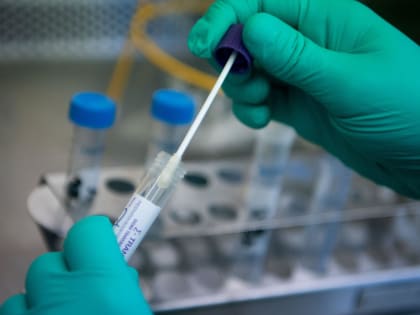 В Саратовской области за сутки — 185 новых случаев коронавируса. В Балаковском районе — 21