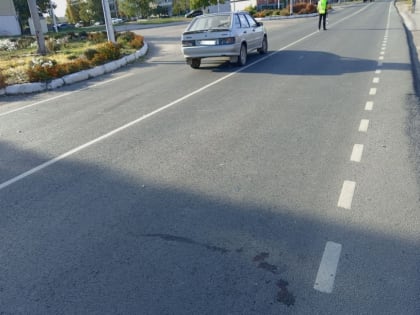 Семилетний мальчик перебегал дорогу и попал под машину. Он в тяжелом состоянии