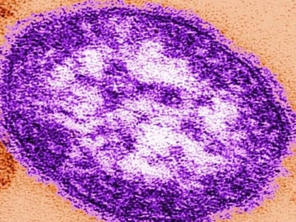 В Саратовской области зарегистрированы уже два очага кори