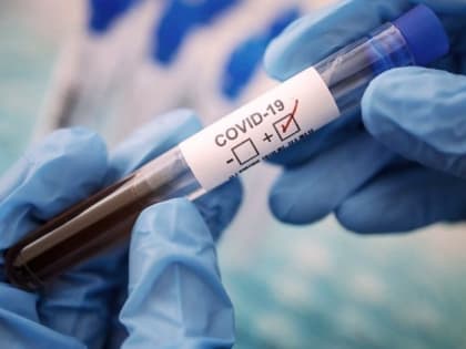  30 января в Саратовской области зарегистрирован 131 новый случай заболевания коронавирусом