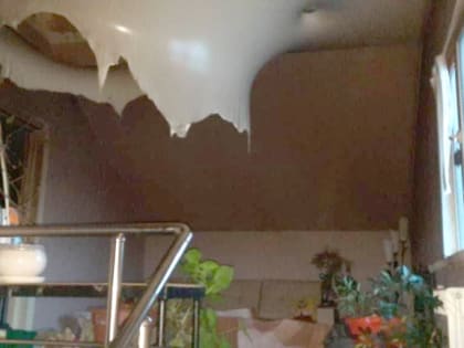 В Ленинском районе молодой мужчина госпитализирован с ожогами