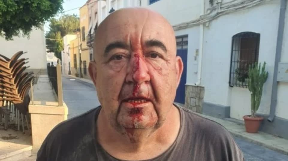 Rompen la nariz a pedradas a un concejal socialista de Almería: “Querían matarle”