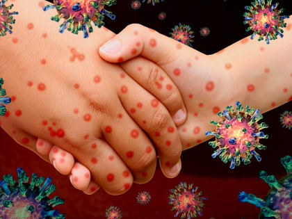 Энтеровирусная инфекция: угроза для детей и взрослых