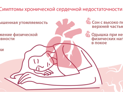 Хроническая сердечная недостаточность - что это?