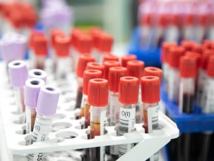 В Тюмени у пациентки выявили разрыв аневризмы во время сдачи крови