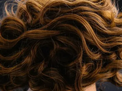 Тюменцам рассказали, как понять, что пора пересаживать волосы: ключевые признаки и советы