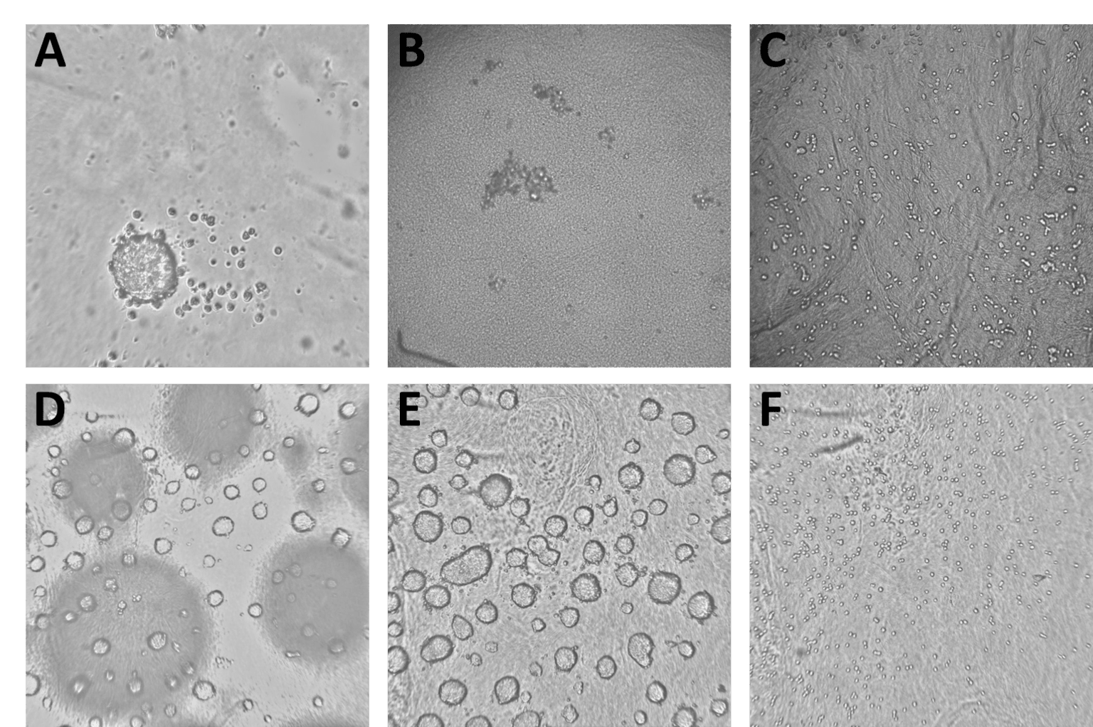 1-spheroid-detection.png