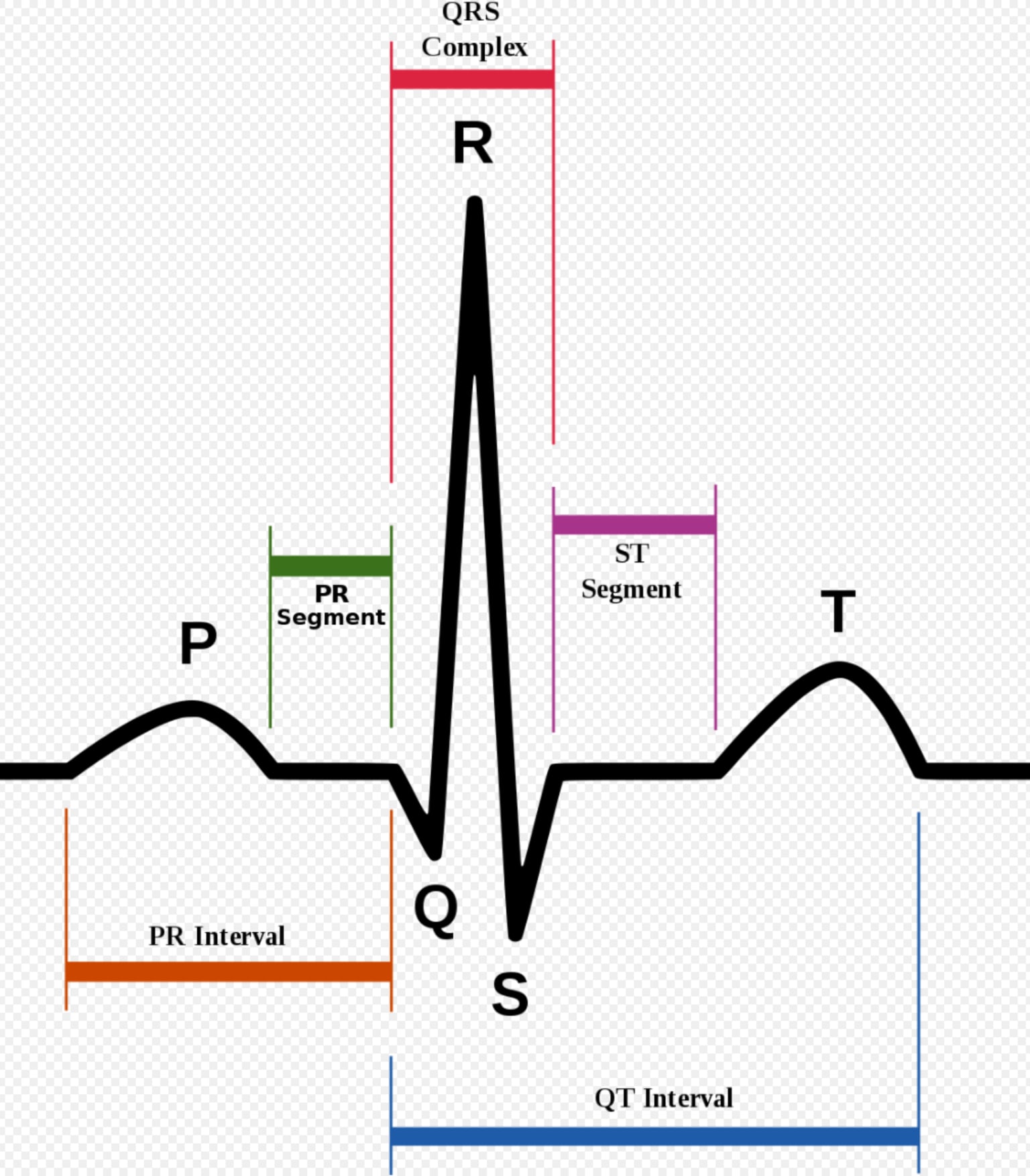 2-ecg-classification-digital-healthcare.png