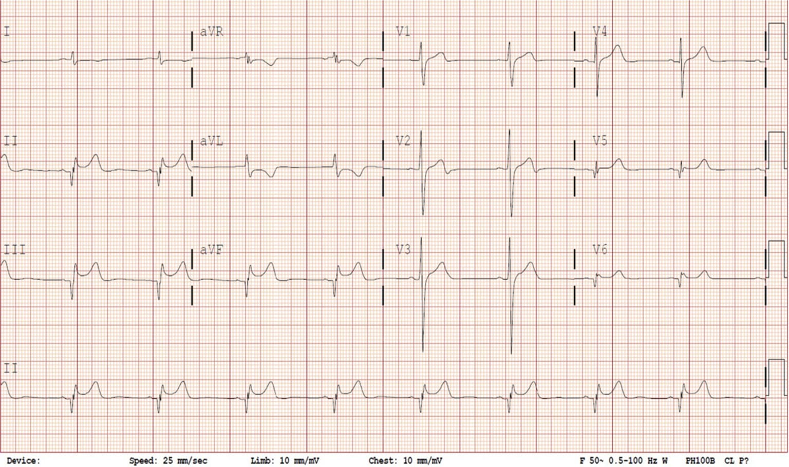 1-ecg-classification-digital-healthcare.png