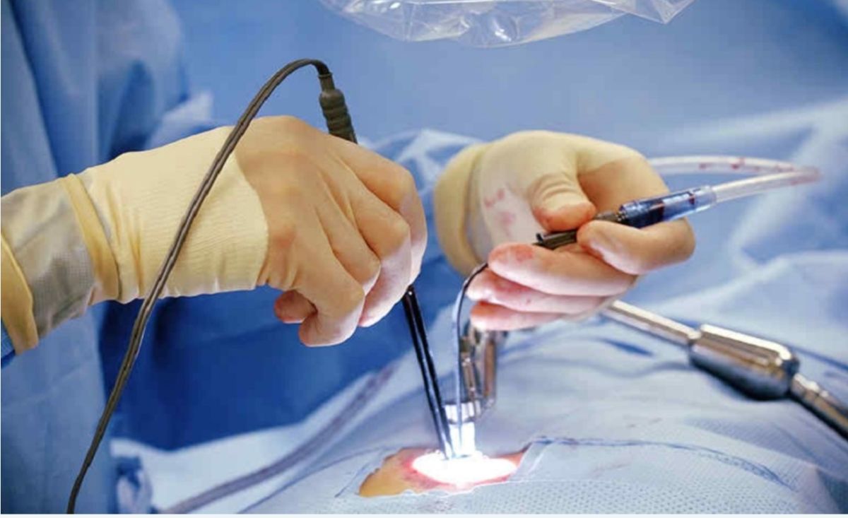 CERVICAL PLATING | सर्विकल बॉडी स्थिरीकरण (फिक्सेशन) | Dr. Yashpal Singh  Rathore | Consultant Neurosurgeon