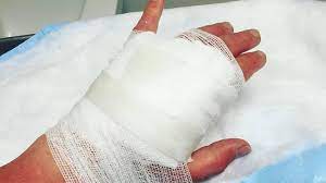 £115k Fine after Machine Cuts Worker's Hand Off