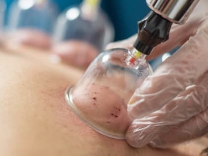 Основано на реальных событиях: процедура, которая спасает казанцев от неожиданных проблем со здоровьем