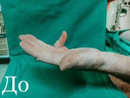 Врач РКБ выиграл первое место в сфере пластической хирургии на конкурсе молодых ученых России