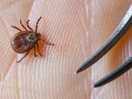 5 чистопольцев обратились за медицинской помощью из-за укусов клещей