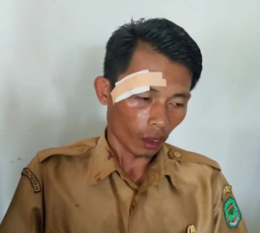 Guru Arpan Lisman (28) Dianiaya Oleh Seorang Siswa Saat Menegur Aksi Bolos di Jam Pelajaran di SMP Negeri 1 Baebunta Selatan, Kabupaten Luwu Utara, Sulawesi Selatan