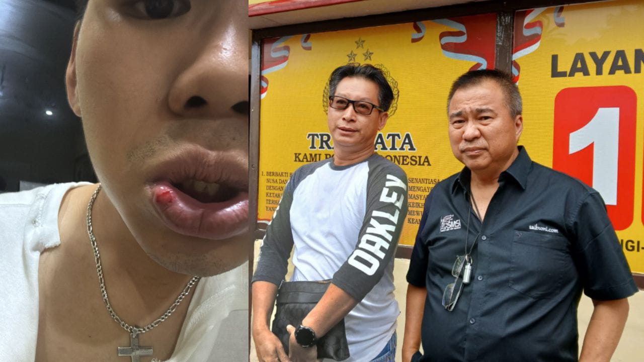 Jengkel Kasus Penganiayaan Anaknya Lamban Ditangani Polisi, Ayah Korban Datangi Polsek