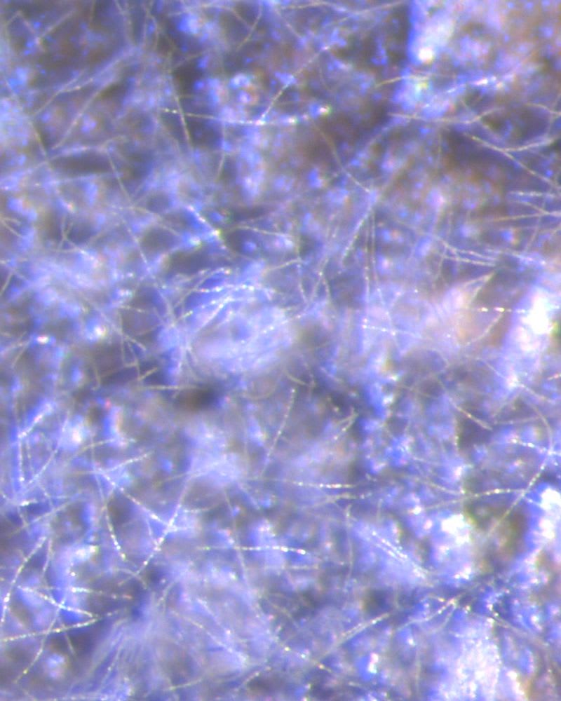 Manchas foliares fúngicas de tipo Cercospora