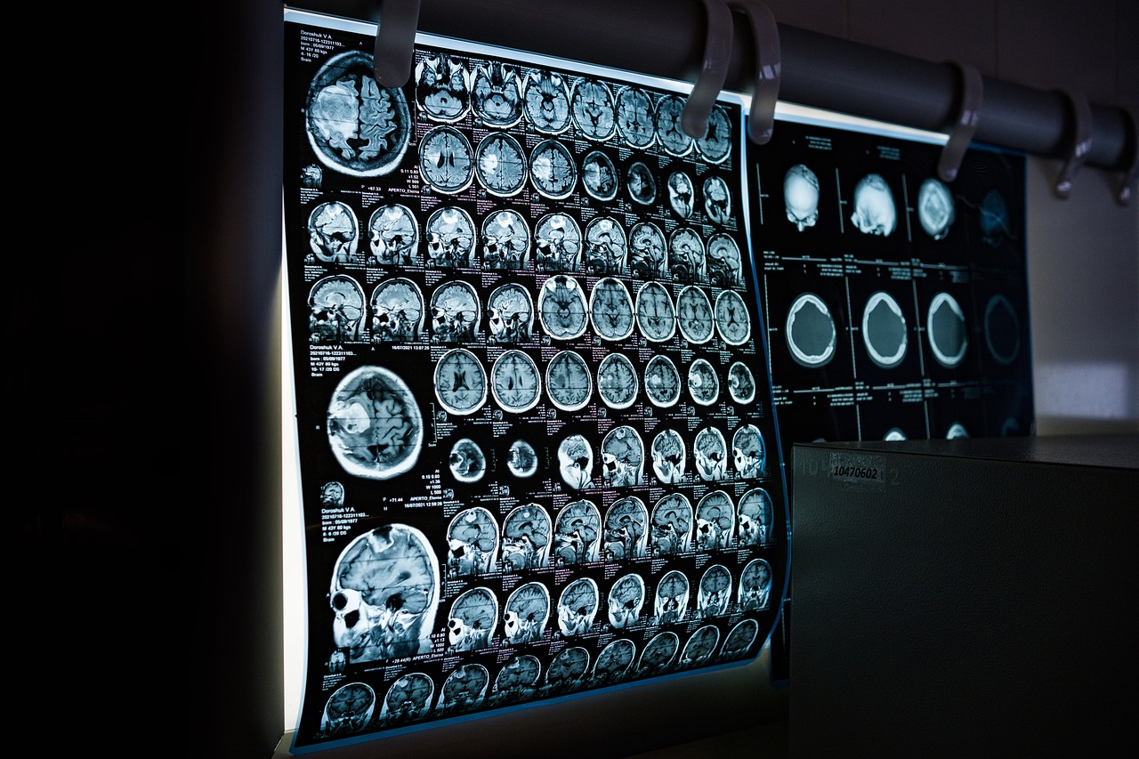 Injury diagnosis and management comparison showing MRI exams detecting ligament tears accurately.
