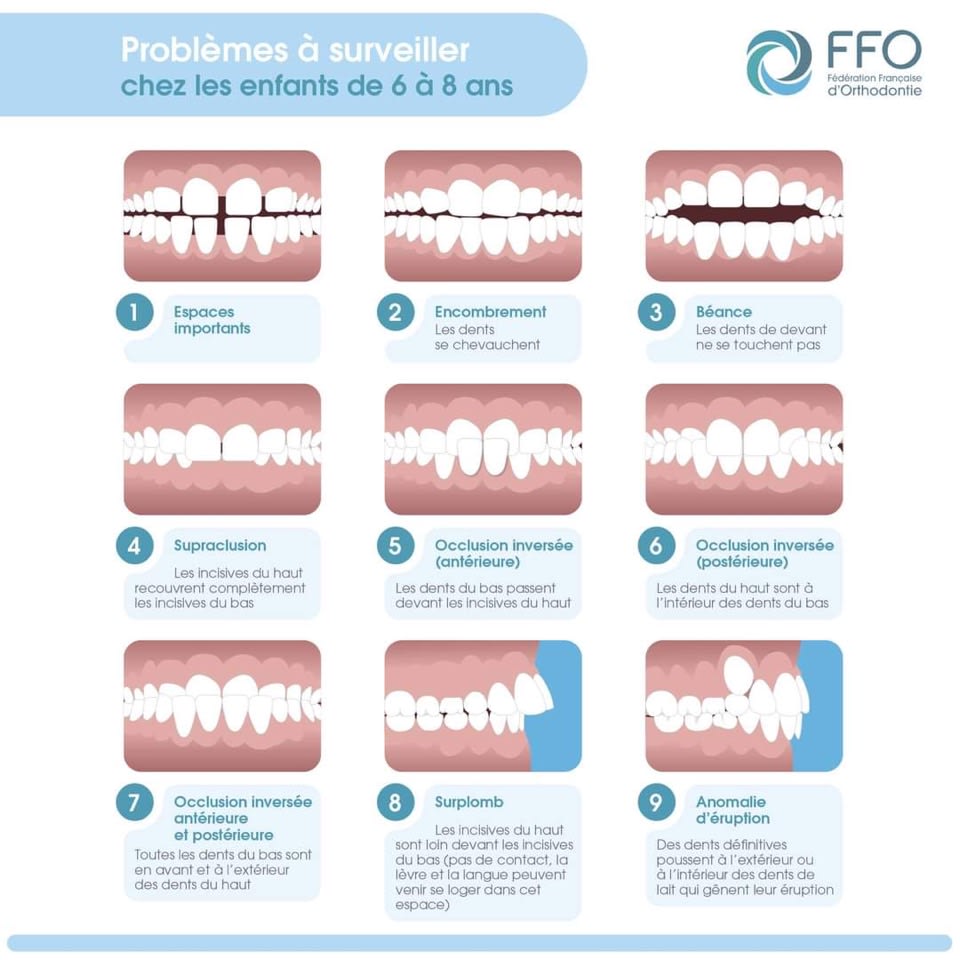 Visuel montrant les maloclusion à traiter chez les enfant de 6 à 8 ans.