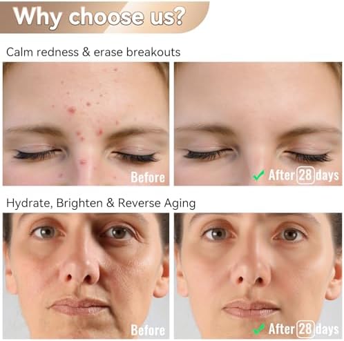 Vue 4 de Masque Led Visage Luminotherapie