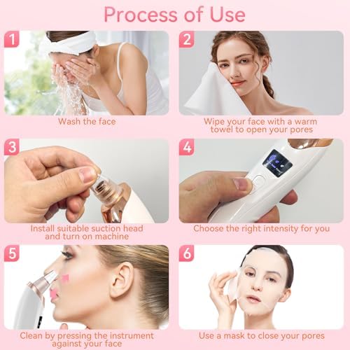 Vue 7 de Extracteur De Points Noirs