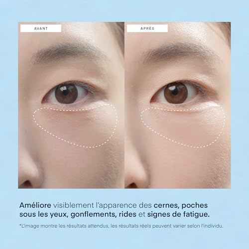 Vue 4 de Patchs Yeux Pour Cernes