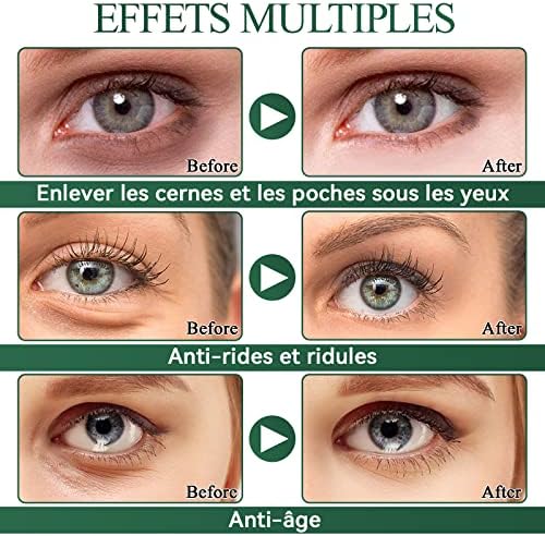 Vue 3 de Eveellyn Patch Yeux Patch
