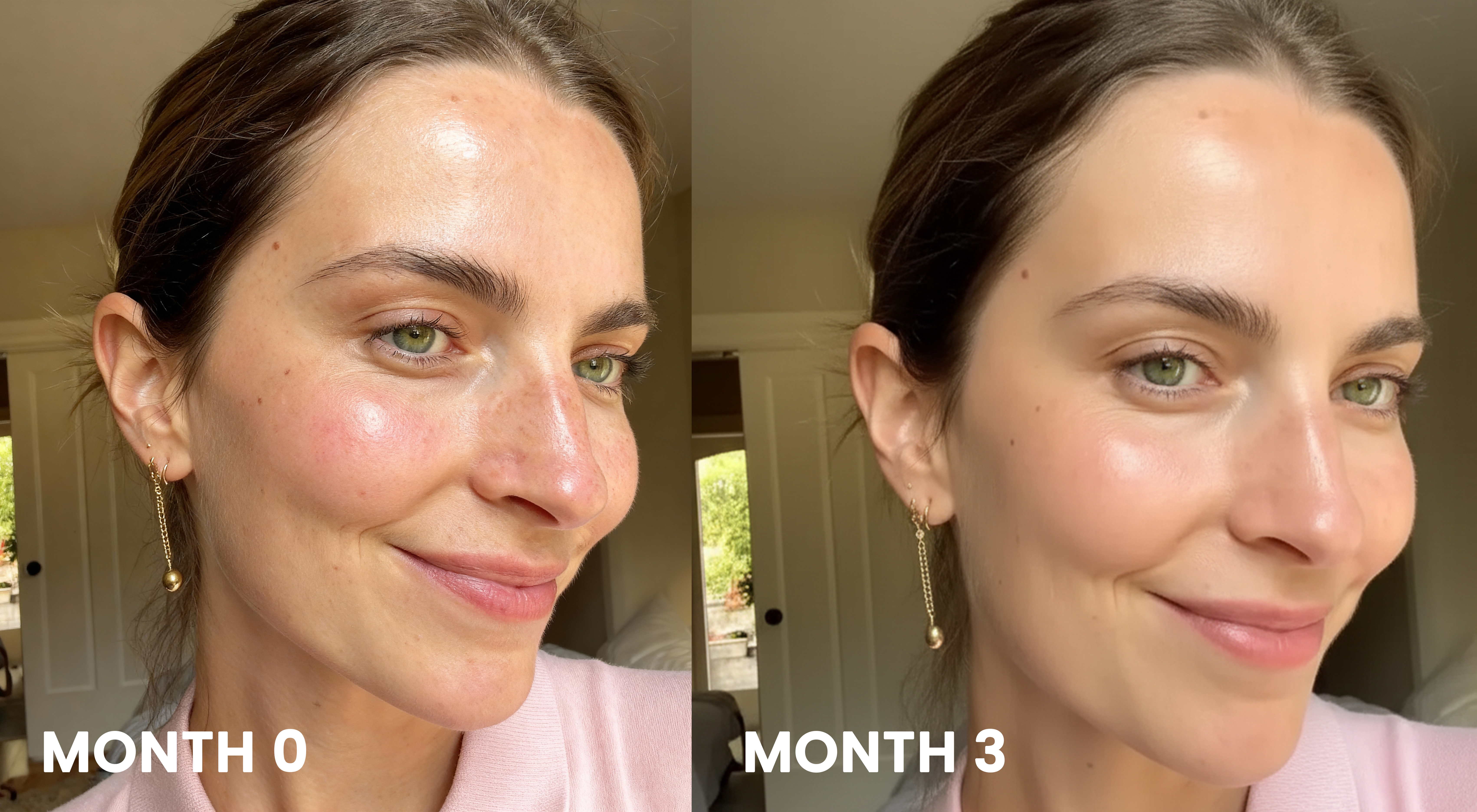 Before and After - Month 0 vs Month 3