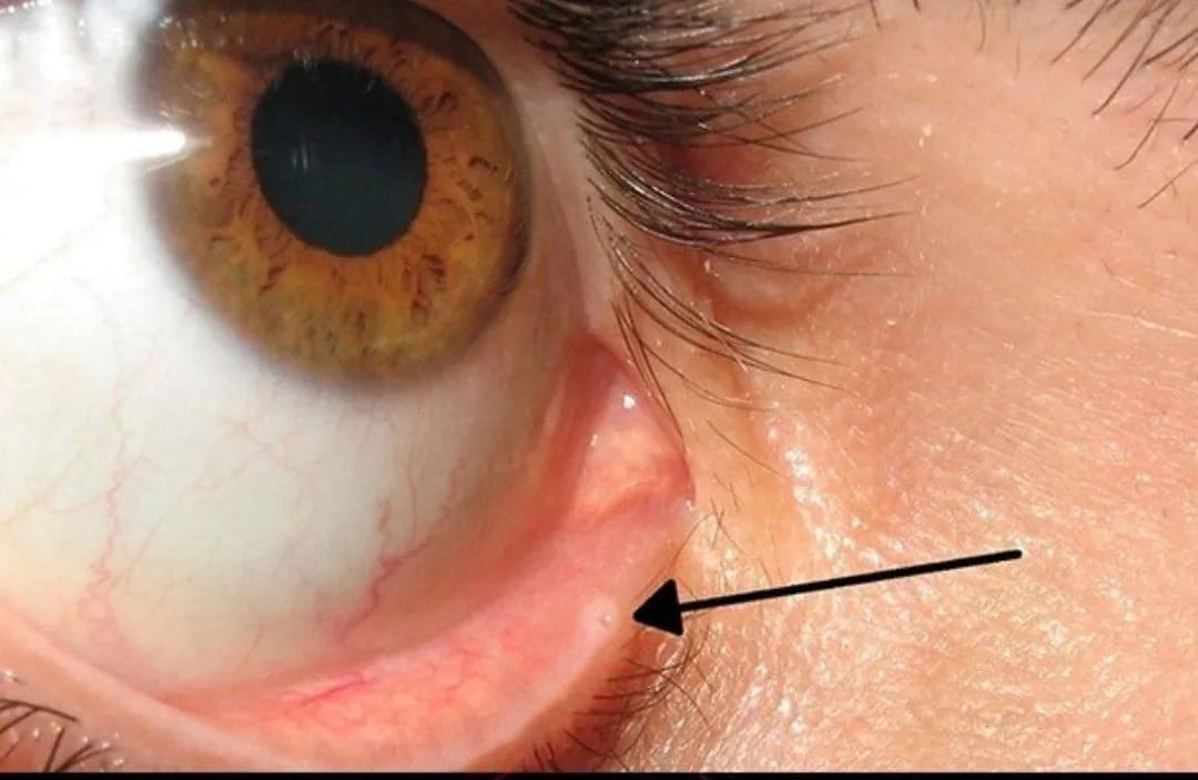 Post image for Fun fact about your eye