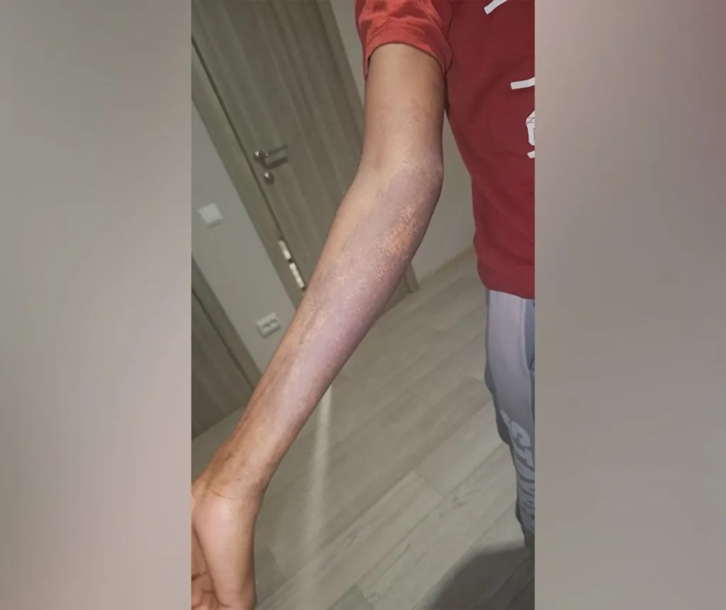 ‘My Skin Was Peeling’ – The African Women Tricked Into Making Russian Drones