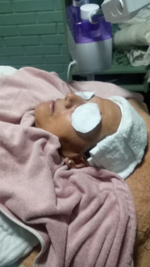 Limpieza facial profunda #1
